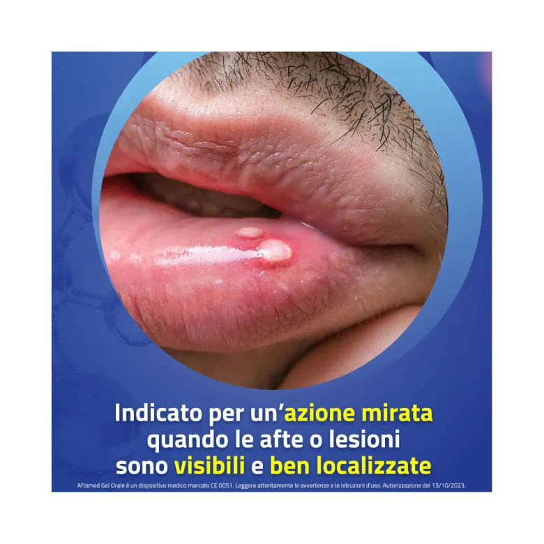 Aftamed Gel Orale 10ml