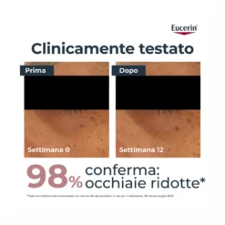 Contorno occhi