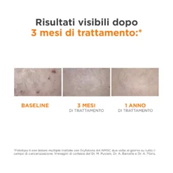 Isdin Eryfotona AK-NMSC Fluid SPF100+ 50ml - Protezione Solare