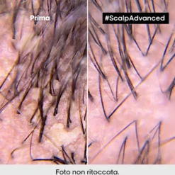 LP SE Scalp A-Dndrf Shp 500 R VB98