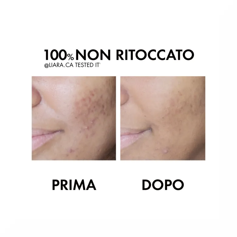 Vichy Normaderm Trattamento Idratante Doppia Azione 50ml